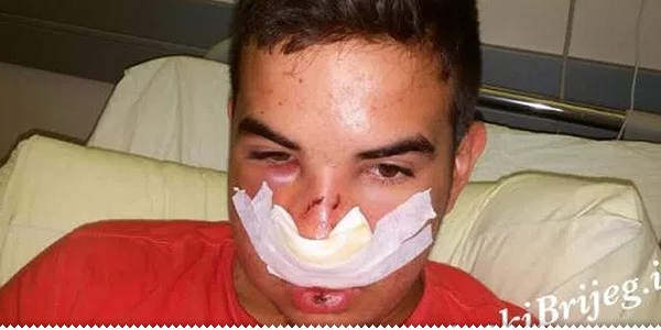 Policija i tužiteljstvo: Dječak iz Širokog Brijega još službeno nije pretučen