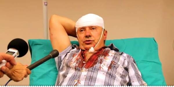 Slavo Kukić brutalno pretučen u svom mostarskom uredu u bolnici
